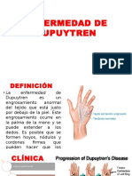 Dupuytren y Dequervain