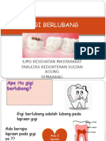 Penyuluhan Gigi Berlubang