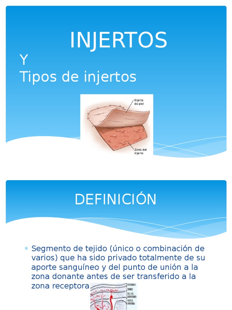 Tipos de Injertos Hueso Piel