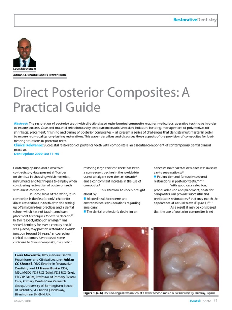 Posterior Composite | PDF | Dental Composite | Tooth Enamel