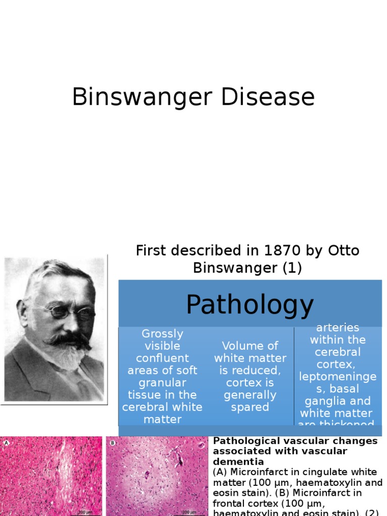 Binswanger Disease PDF Resonance Imaging Medical Imaging