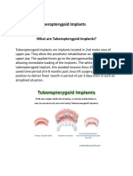 Tuberopterygoid Implants