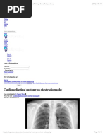 Cardiomediastinal Anatomy On Chest Radiography - Radiology Case