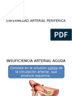 Enfermedad Arterial Periferica