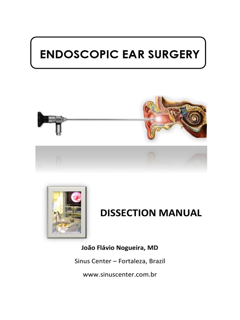 Endoscopic Ear Surgery Manual PDF Endoscopy Surgery