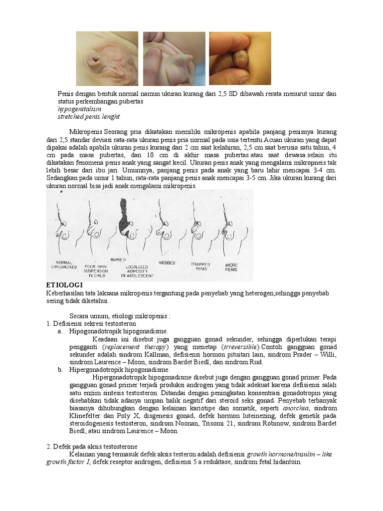 Pe ER Micropenis PDF