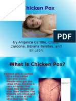 Chicken Pox: by Angelica Carrillo, Cristal Cardona, Bibiana Benites, and Eli Leon