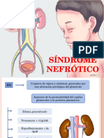 Síndrome Nefrótico