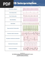 10 Ecg Heart Rhythms Pdf