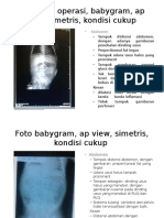 Expertise Foto Babygram, AP View, Simetris