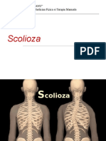 Tratamentul Scolioze1