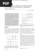 ECG Changes in Hypokalaemia | PDF | Nutrition | Diet & Nutrition