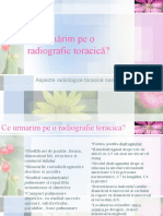 Ce Urmărim Pe o Radiografie Toracica