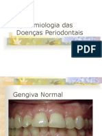 Epidem Doencas Periodontais2008
