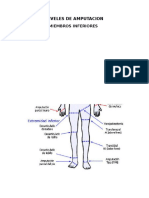 Niveles de Amputacion