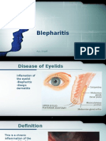 Blepharitis: Inflammation of the Eyelids