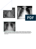 CXR.docx