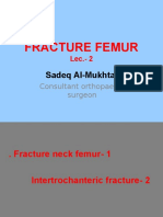 Fracture Femur