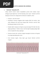 Download Contoh Gambaran Ekg Abnormal by Ferdiastuti Dias SN332128605 doc pdf
