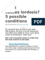 Lordosis