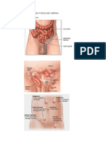 Anatomi Dan Fisiologi Hernia