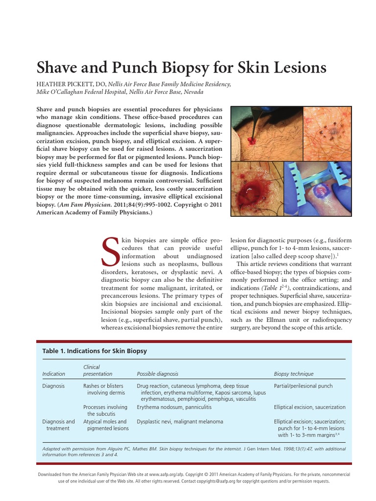 Shave and Punch Biopsy for Skin Lesions.pdf Biopsy Health Care