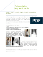 Radiografía pulmonar: Análisis e interpretación