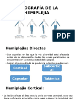 Clínica Topográfica Del Paciente Hemiplejico