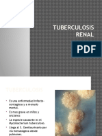 Tuberculosis Renal