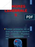 Tumores Cerebrales