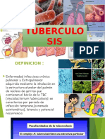 Tuberculosis