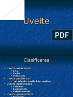 Uveite