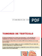 tumores testiculares