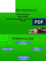 Tumor Esofagus