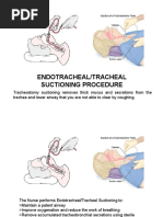 Endotracheal Suctioning PDF | PDF | Respiratory System | Respiratory Tract
