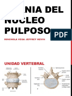 Hernia Del Núcleo Pulposo