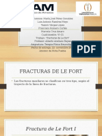 Lesiones de Lefort