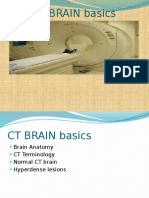CT Brain Basics