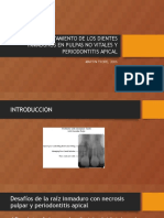 3) El Tratamiento de Los Dientes Inmaduros Con Pulpas