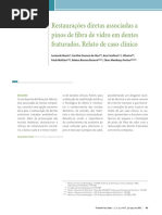 Restauracoes Diretas Associadas a Pinos de Fibra