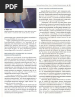 Capitulo Restauraçoes de Dentes Endo Pereira