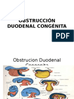 Obstrucción Duodenal Congénita