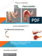 Pancreatitis