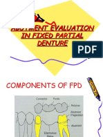 Abutment Evaluation in Fixed Partial Denture