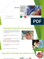 Taquipnea Transitoria Del Recien Nacido