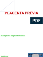 04 Placenta Prévia e DPP (mod) - slide 2013.ppt