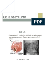 Ileus Obstruktif Diana