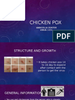 chicken pox