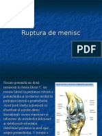 ruptura de menisc.ppt