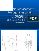 Total Hip Replacement